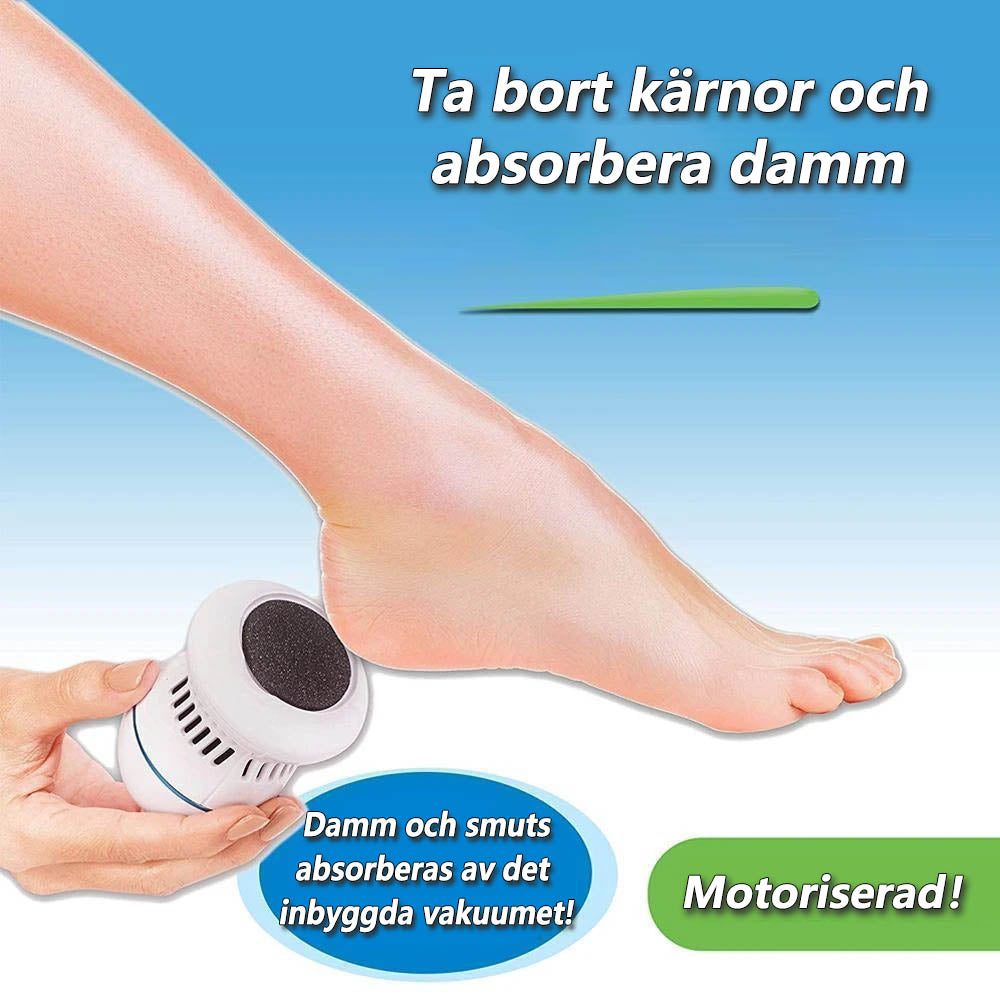 Callus Remover for Smooth Feet