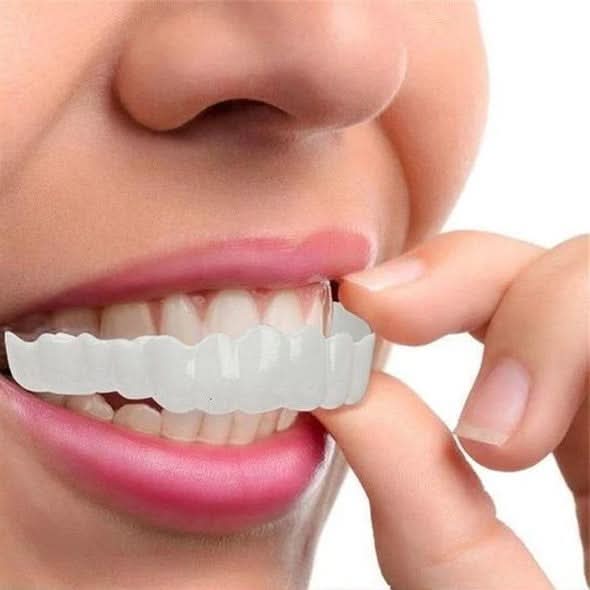 Upper and Lower Smile Veneer Kit
