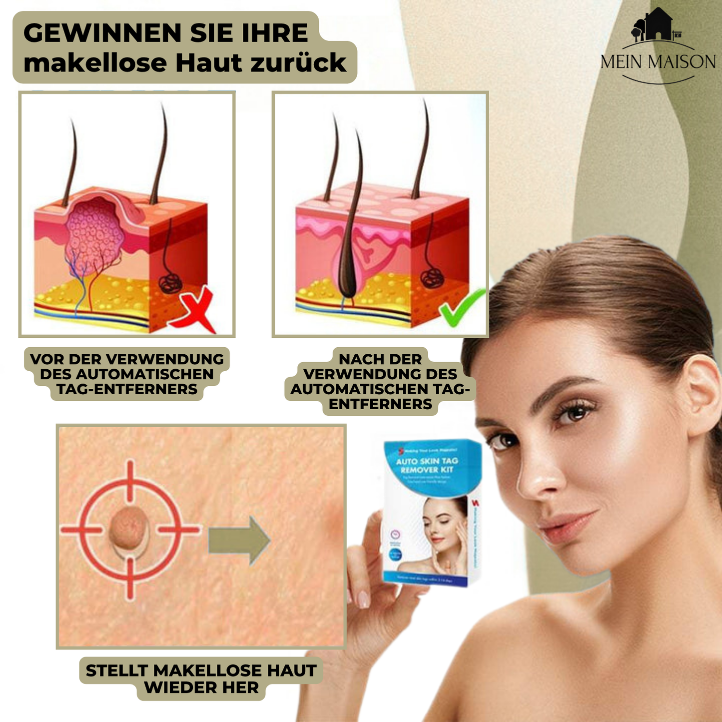 SkinClear Wart and Mole Remover | Gentle and Effective | For Face and Body