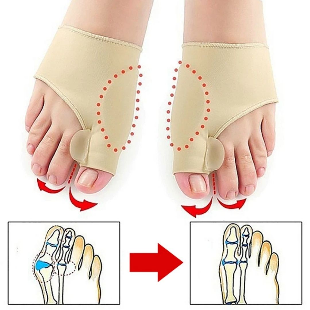 Bunion Separator for Big Toe Alignment and Pain Relief – Non-Invasive Aid