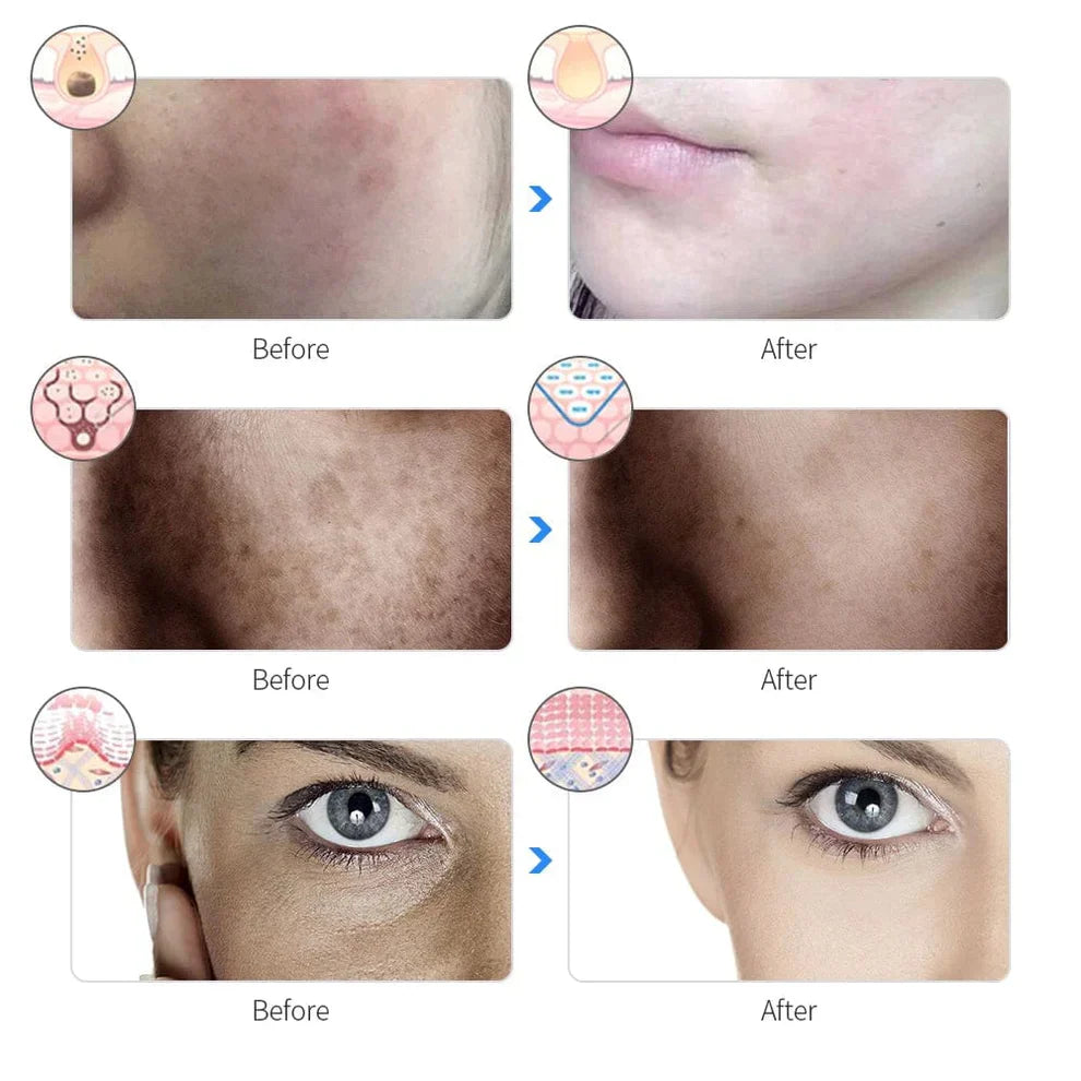 Revitalizing LED Facial Mask for Radiant Skin