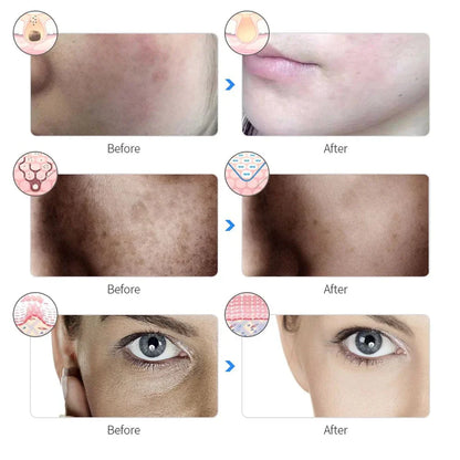 Revitalizing LED Facial Mask for Radiant Skin