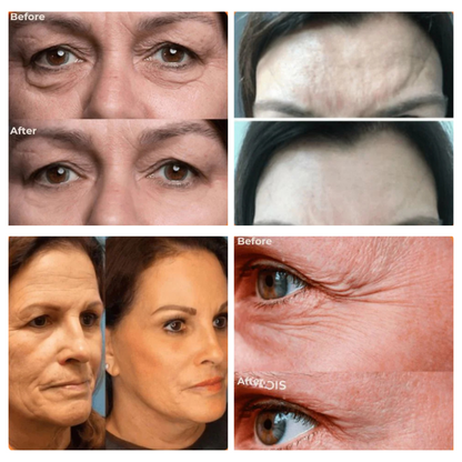 Revitalize Your Skin Overnight with Collagen Infusion | Buy 1 Get 1 Free Today