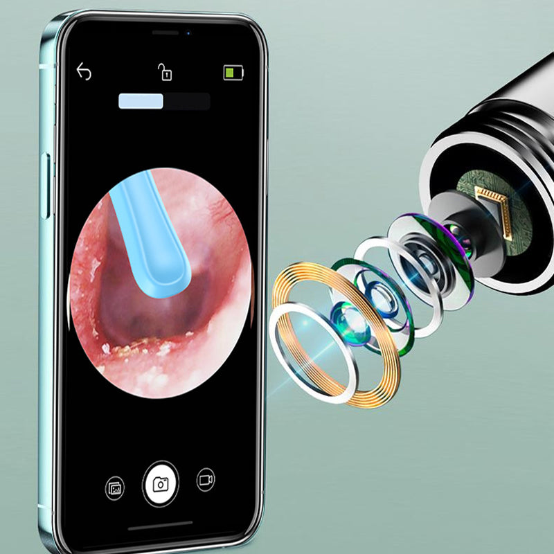 Earwax Removal with Live HD Camera Guide
