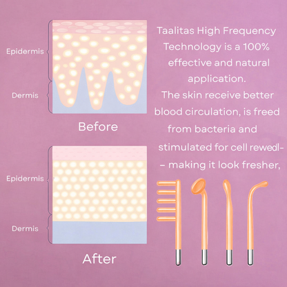 Glow frequency stick - The High frequency stick for your home