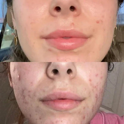 RadianceWave™ – Gentle LED Therapy for Flawless Skin