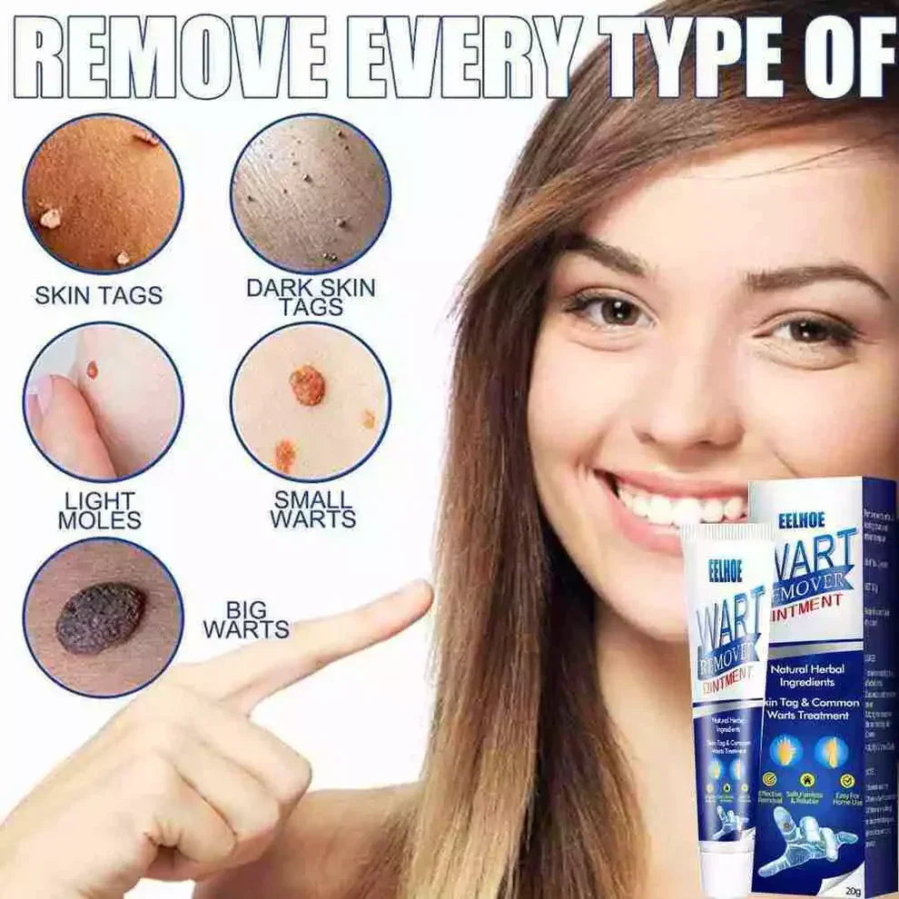 Wart Removal Cream – Fast and Efficient Treatment