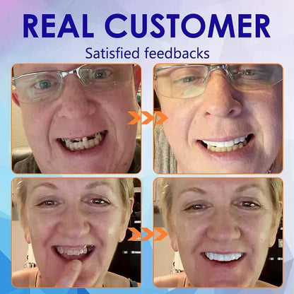 FlexiSmile Complete Denture System for Enhanced Comfort
