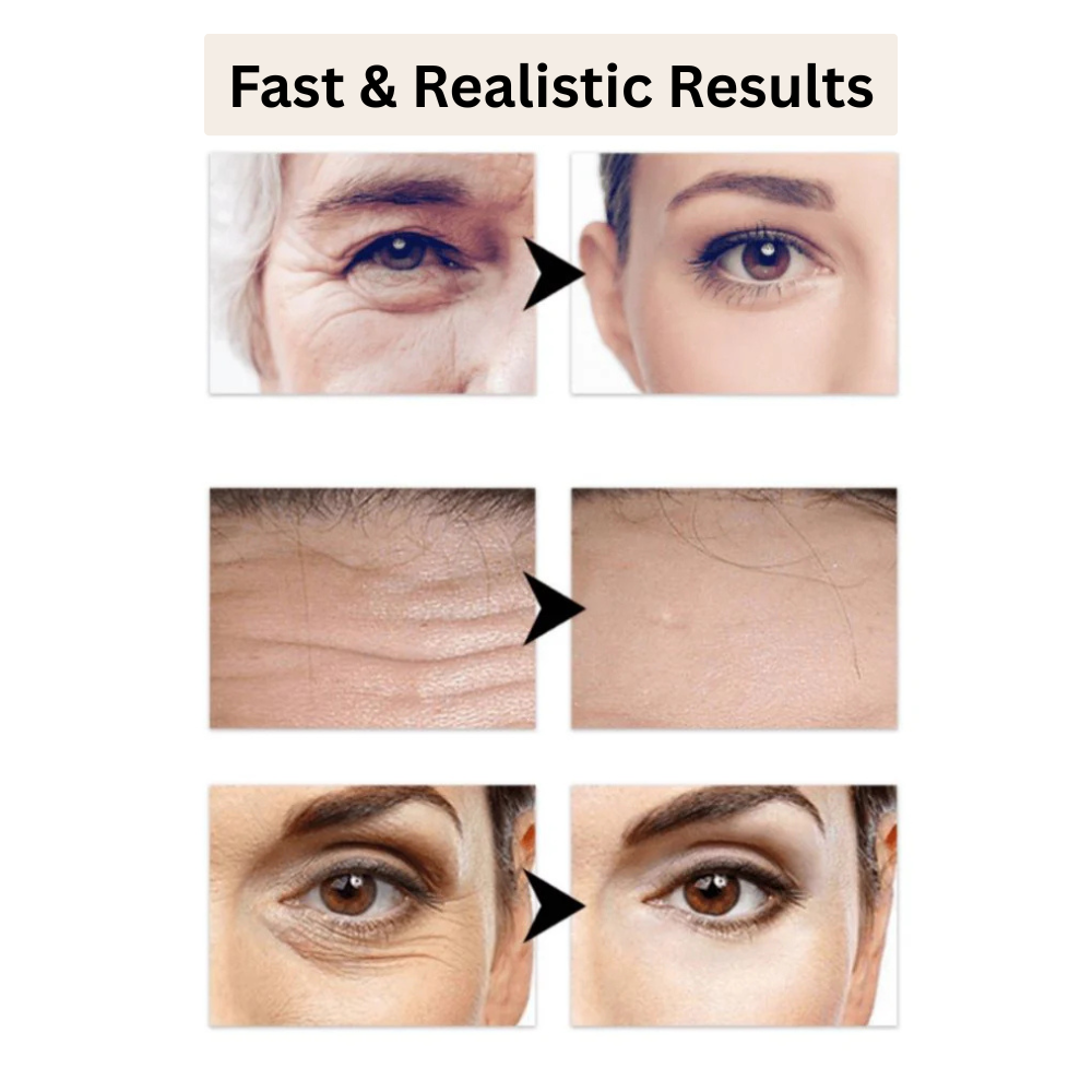 Revitalize Your Skin Overnight with Collagen Infusion | Buy 1 Get 1 Free Today