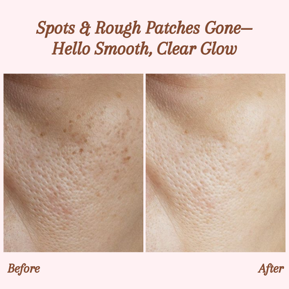 GlowEssence Exfoliating Gel – Reveal Radiant, Silky Skin Instantly