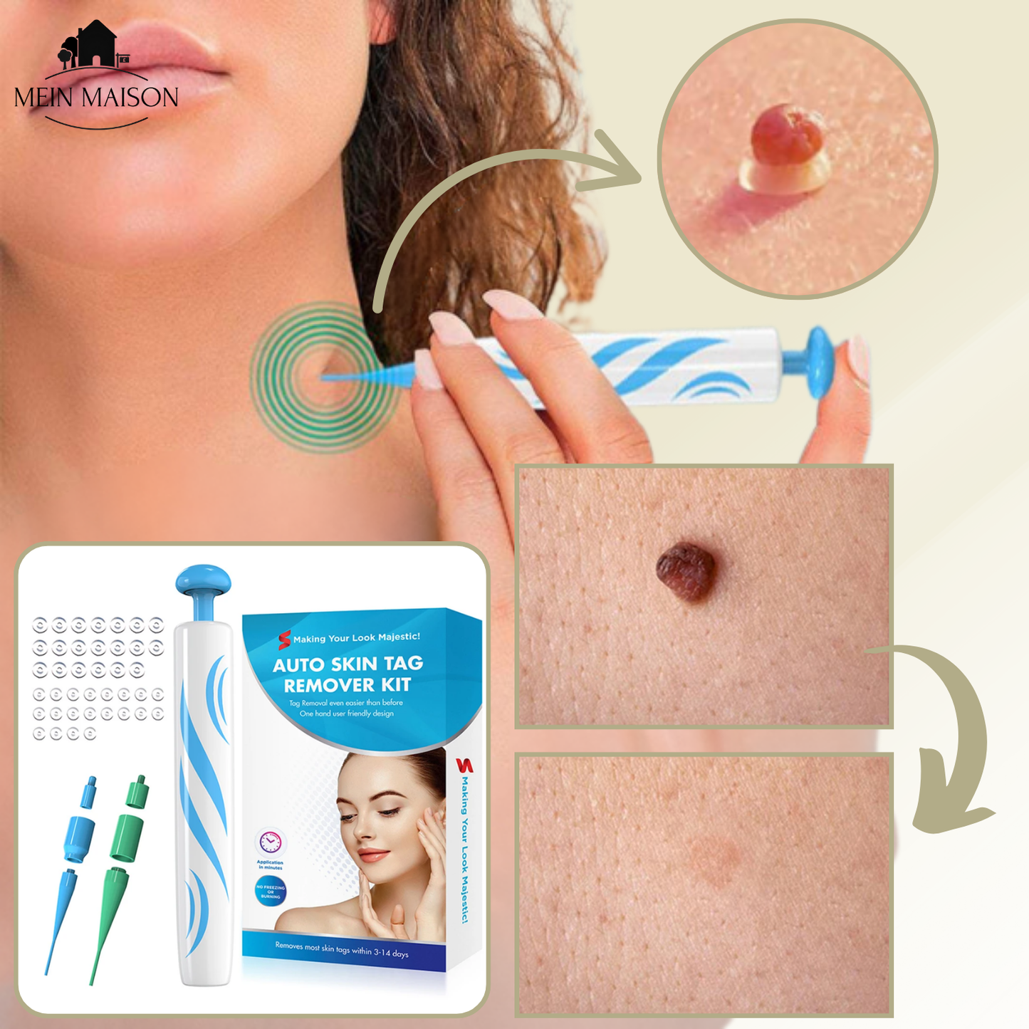 SkinClear Wart and Mole Remover | Gentle and Effective | For Face and Body