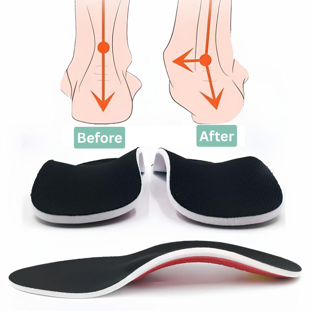 Foot Bliss Insoles - Elevate Comfort & Support (Buy 1 Get 1 Free)