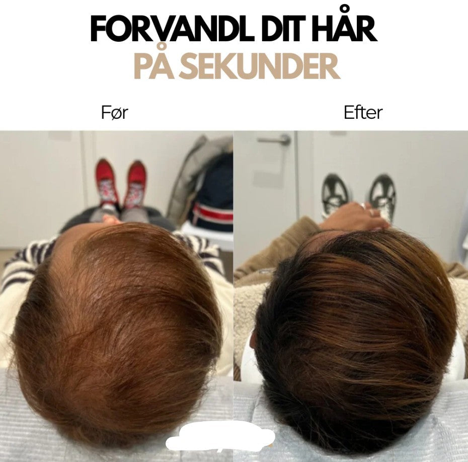 Quick Hairline Concealer Powder for a Fuller Look