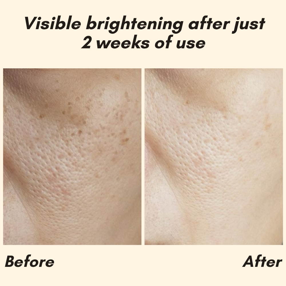 RadiantGlow Essence — Banish Dark Spots for Luminous Skin | Buy One Get One Free