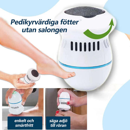 Callus Remover for Smooth Feet
