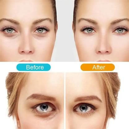 Remove Dark Spots and Wrinkles for Radiant Youthful Skin
