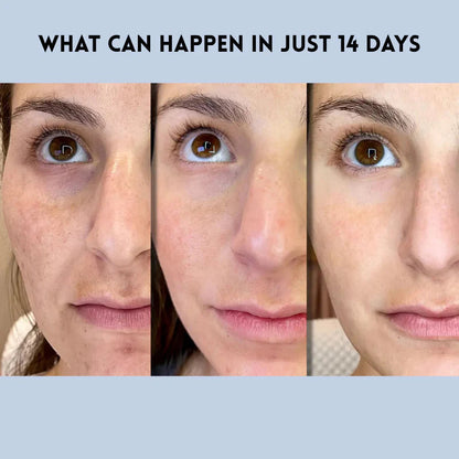 Instant Skin Tightening Strips for a Youthful Glow | Ultra Thin & Breathable | Invisible Under Makeup | For Face, Eyes & Forehead
