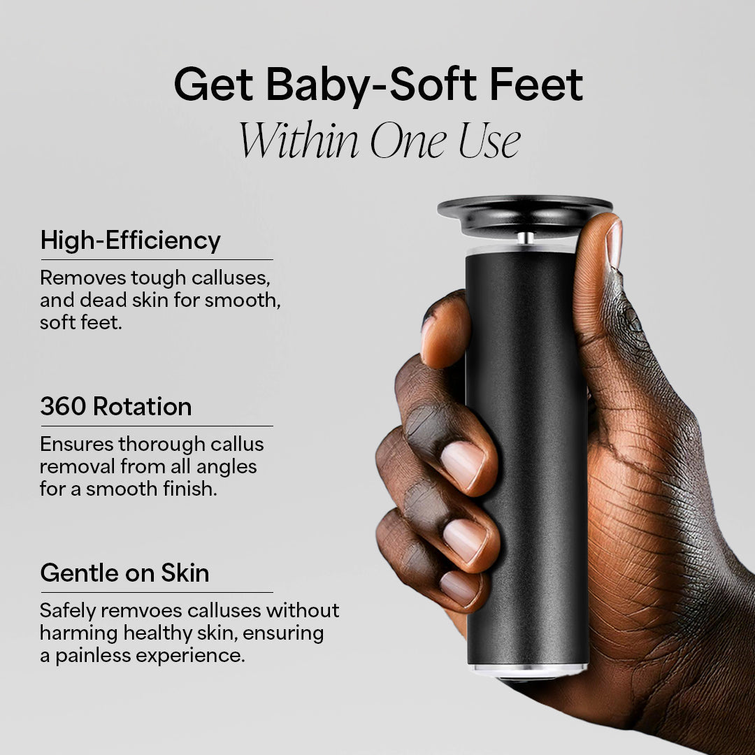 SmoothFeet Pro Electric Callus Remover for Ultimate Foot Care