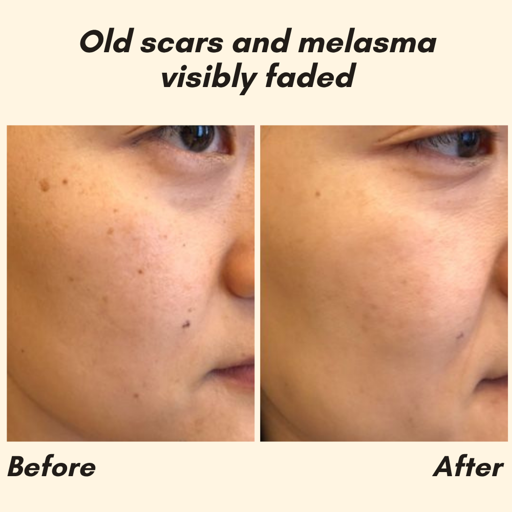 RadiantGlow Essence — Banish Dark Spots for Luminous Skin | Buy One Get One Free