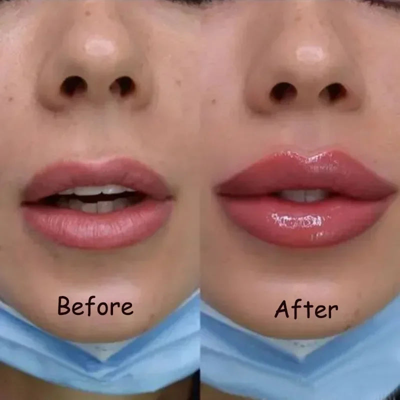 Achieve Fuller Lips Quickly with Lip Plumper Serum