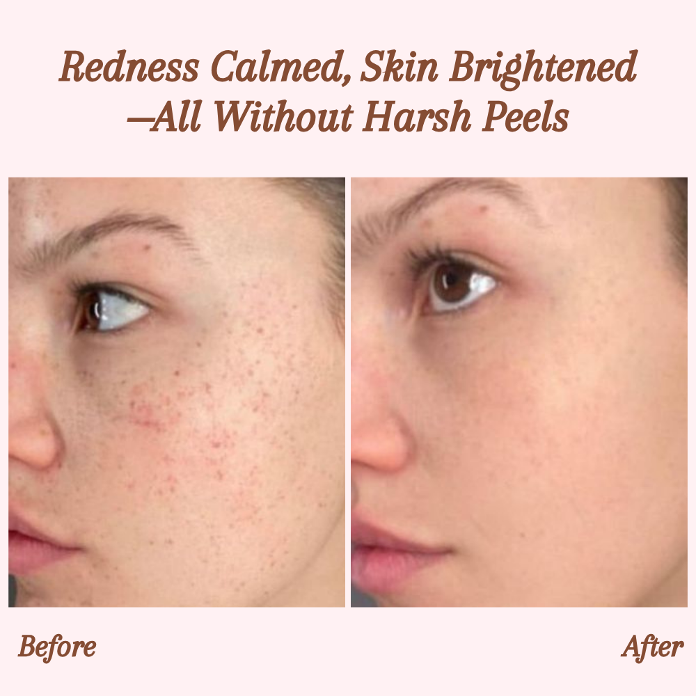 GlowEssence Exfoliating Gel – Reveal Radiant, Silky Skin Instantly