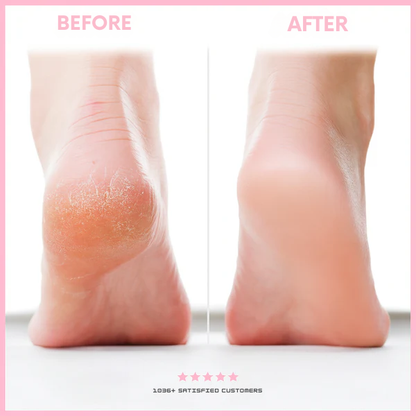 Half Price Offer | ComfortEase Exfoliating Foot Scrub