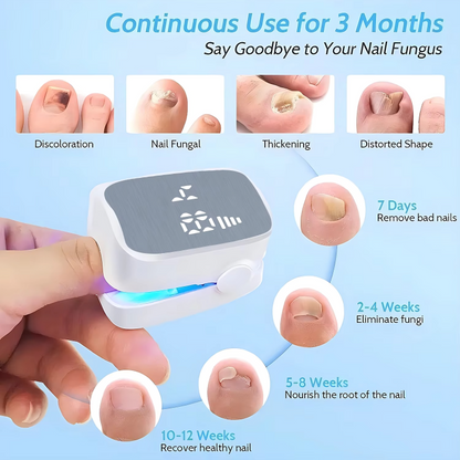 Restore Healthy Nails with FungiGuard™ – 50% Off Today!