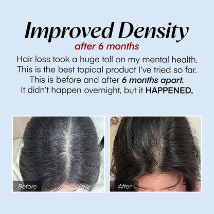 Instant Revive Serum: Transform Your Hair Today!