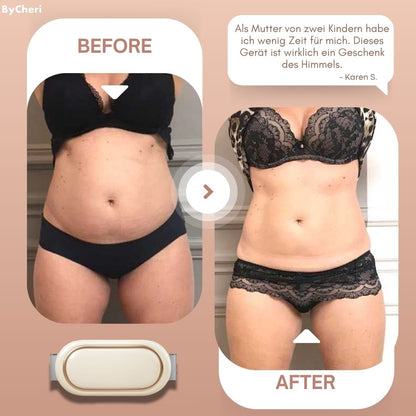 Relax & Burn: The Ultimate Body Sculpting Device