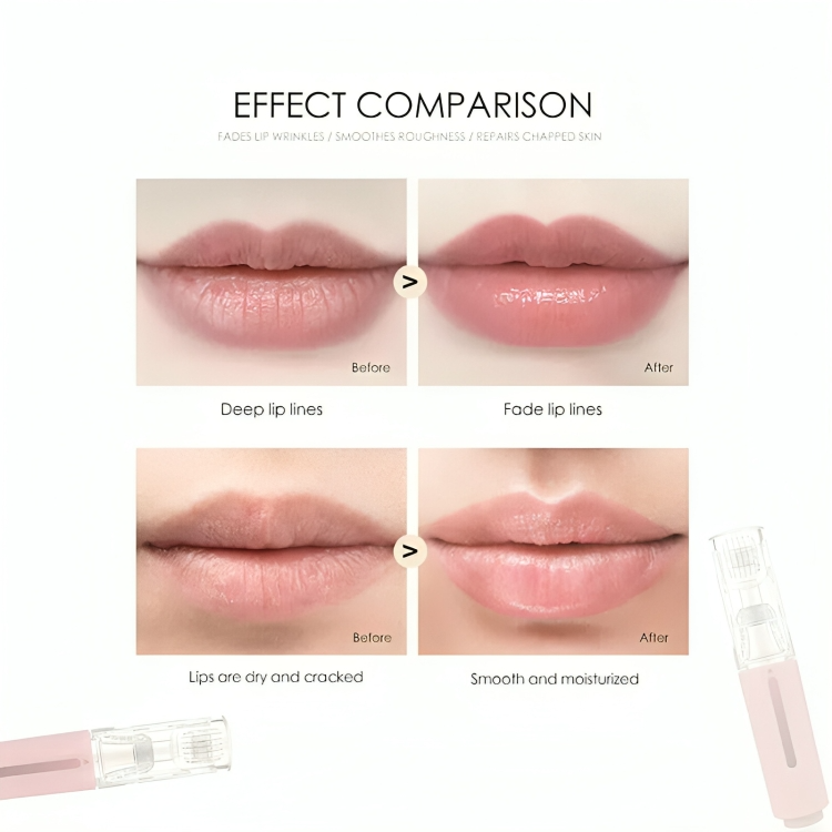 Full & Luscious Lips Without Expensive Treatments!