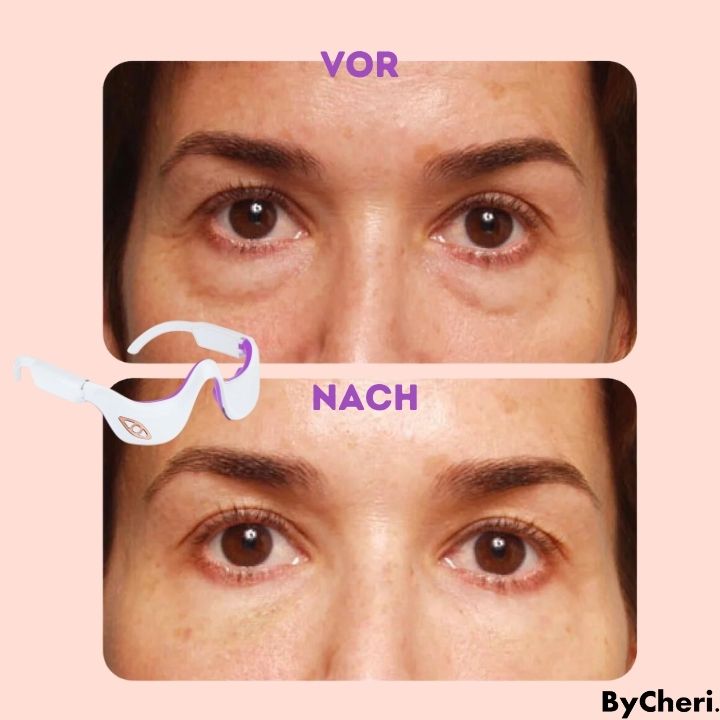 RevitalEyes™: Your Portable Eye Massage Solution