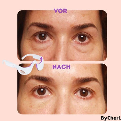 RevitalEyes™: Your Portable Eye Massage Solution