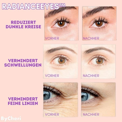 RevitalEyes™: Your Portable Eye Massage Solution