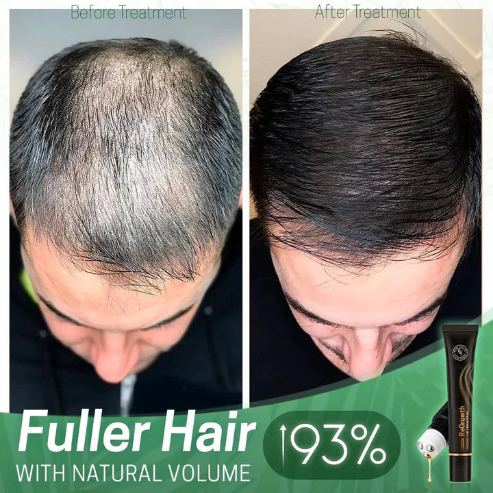 Nourishing Scalp Serum with Roller Applicator for Lush Hair