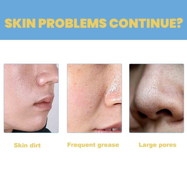 ClearGlow Essence | Pore-Refining Serum for Radiant Skin