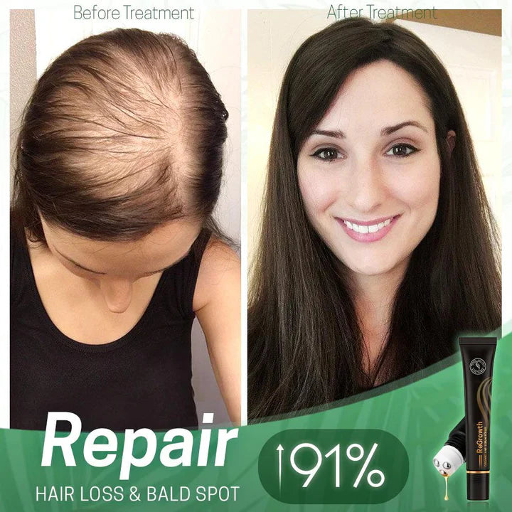 Nourishing Scalp Serum with Roller Applicator for Lush Hair