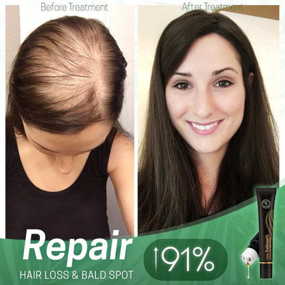 Nourishing Scalp Serum with Roller Applicator for Lush Hair