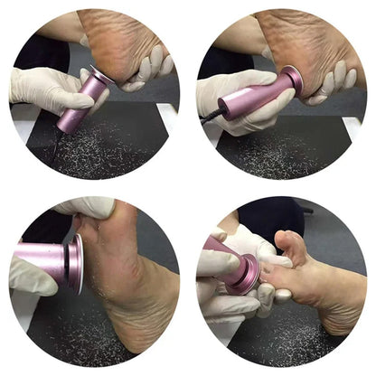 Confident and Comfortable with Silk Insoles - For Callus Relief