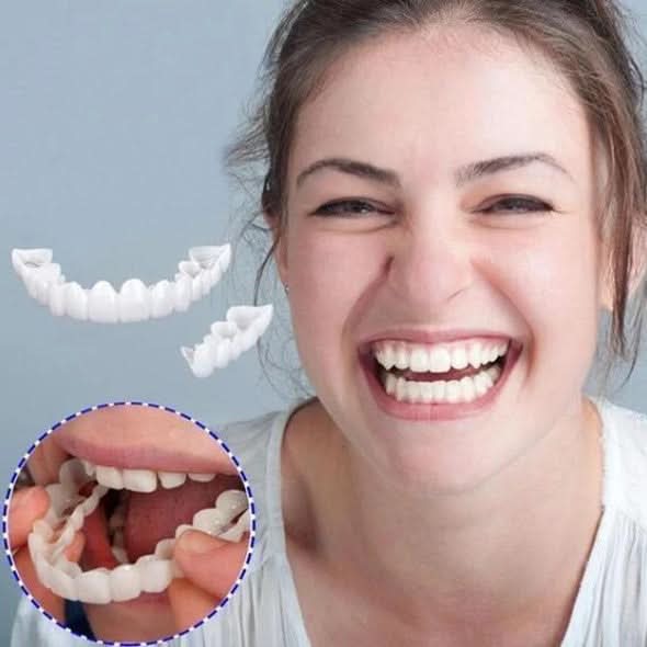 Upper and Lower Smile Veneer Kit