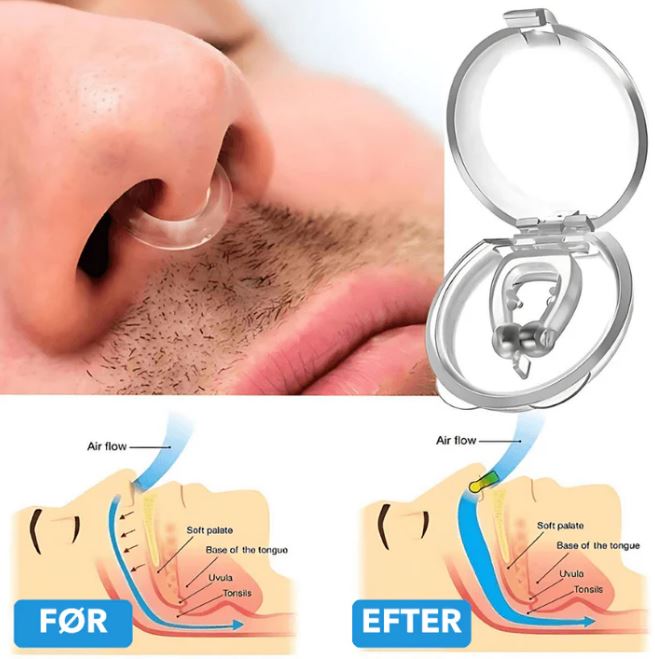 Silicone Snore Relief Device: Enjoy Peaceful Sleep Tonight