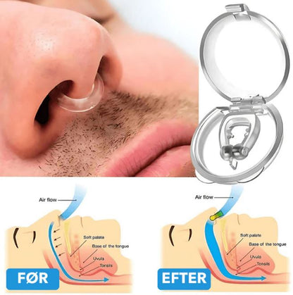 Silicone Snore Relief Device: Enjoy Peaceful Sleep Tonight