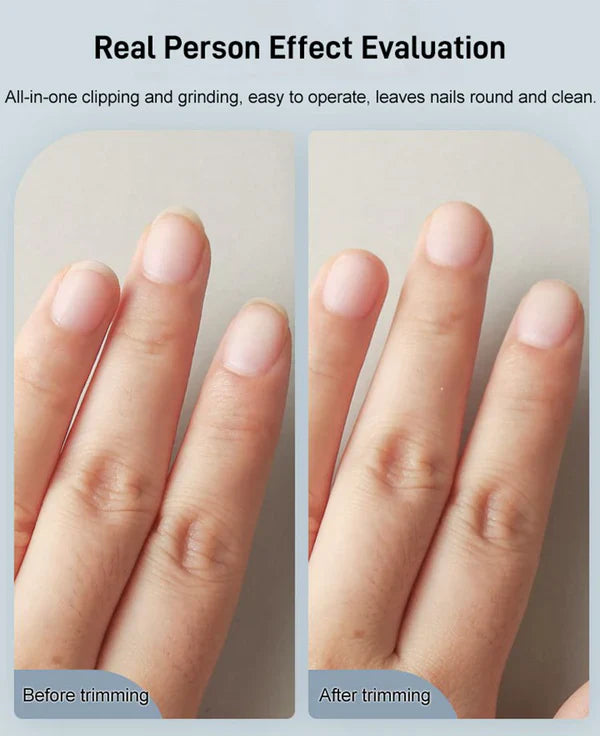 Smart Touch Electric Nail Trimmer for Effortless Grooming