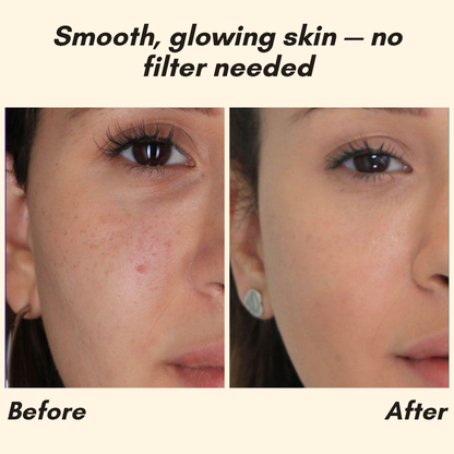 RadiantGlow Essence — Banish Dark Spots for Luminous Skin | Buy One Get One Free