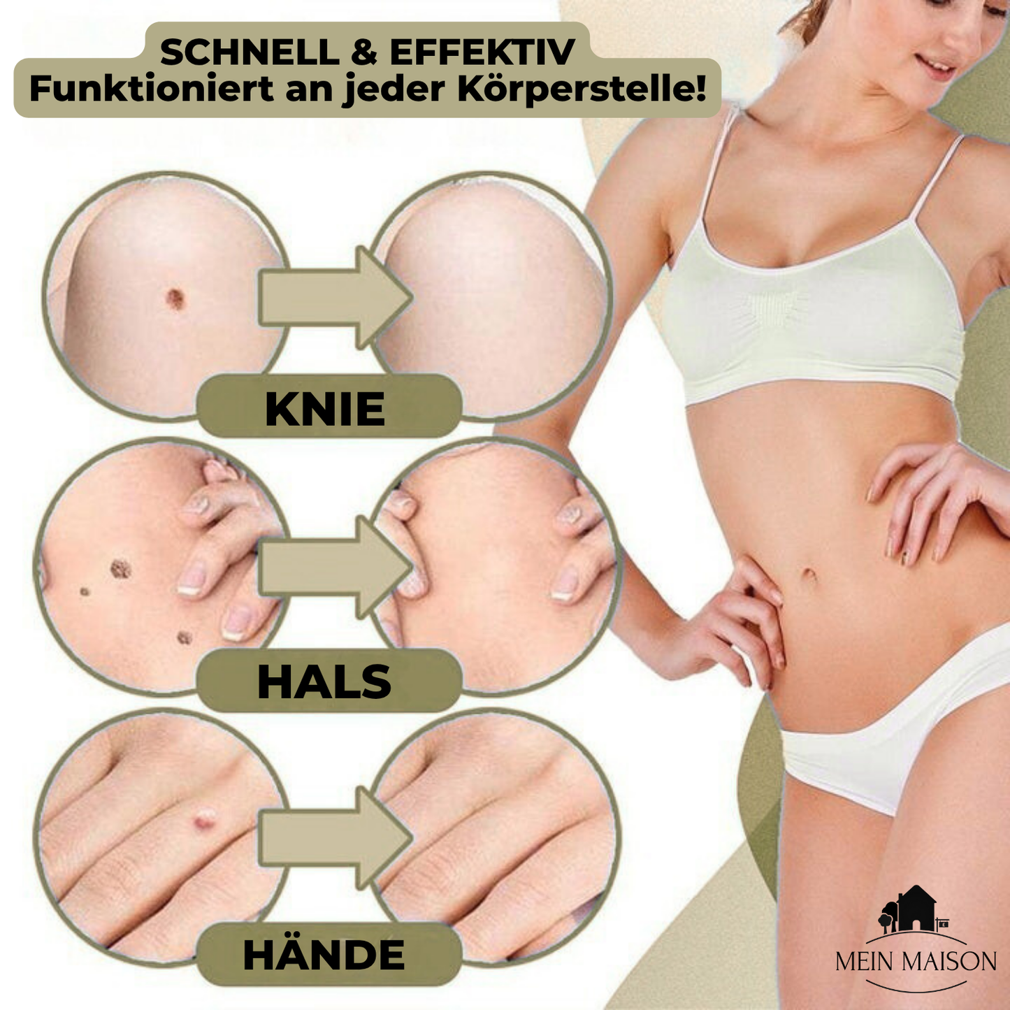 SkinClear Wart and Mole Remover | Gentle and Effective | For Face and Body