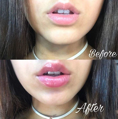 Ultimate Hydrating Lip Gloss for Fuller Lips