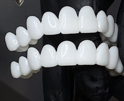 Adjustable White Denture Lens for Direct Smile Enhancement