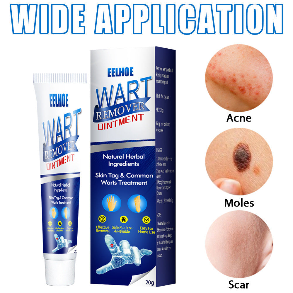 Wart Removal Cream – Fast and Efficient Treatment