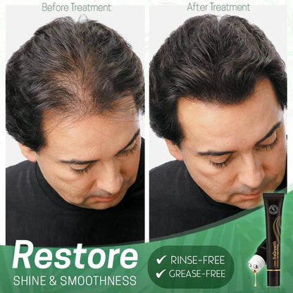 Nourishing Scalp Serum with Roller Applicator for Lush Hair