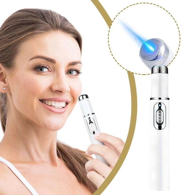 Pain-Free Acne Removal for Smooth, Clear Skin