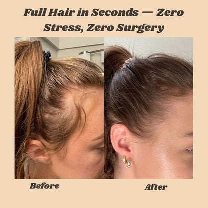 HairBoost Spray — Instantly Enhance Thinning Hair for Confident Living